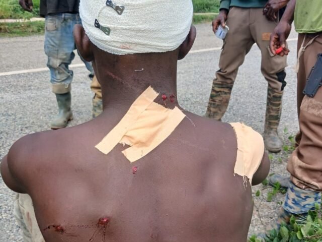 Reforestation worker allegedly shot by illegal chainsaw operators at Abesewa Forest