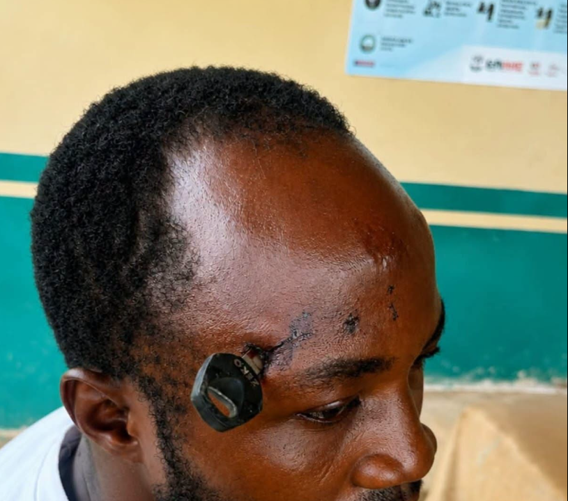Doctors successfully remove motorbike key from farmer’s skull after Jasikan attack
