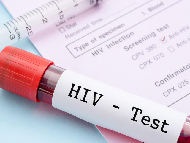 HIV stigma could derail Ghana’s 2030 target – AHF Ghana