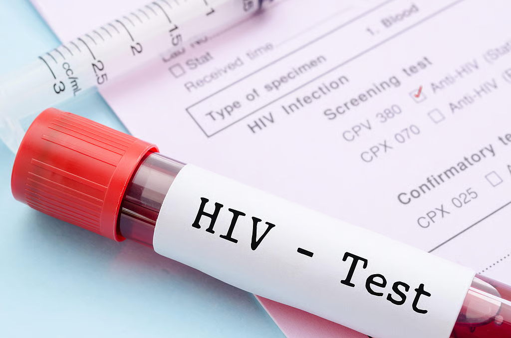 HIV stigma could derail Ghana’s 2030 target – AHF Ghana